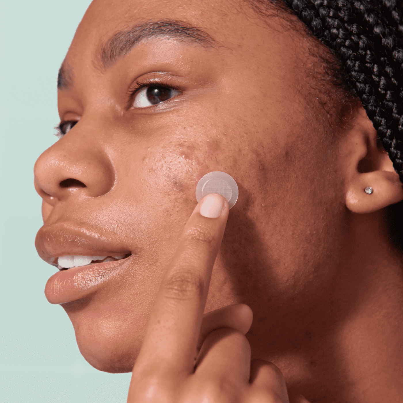 Mighty Patch™ for Early-Stage Blemishes - Daily Clear