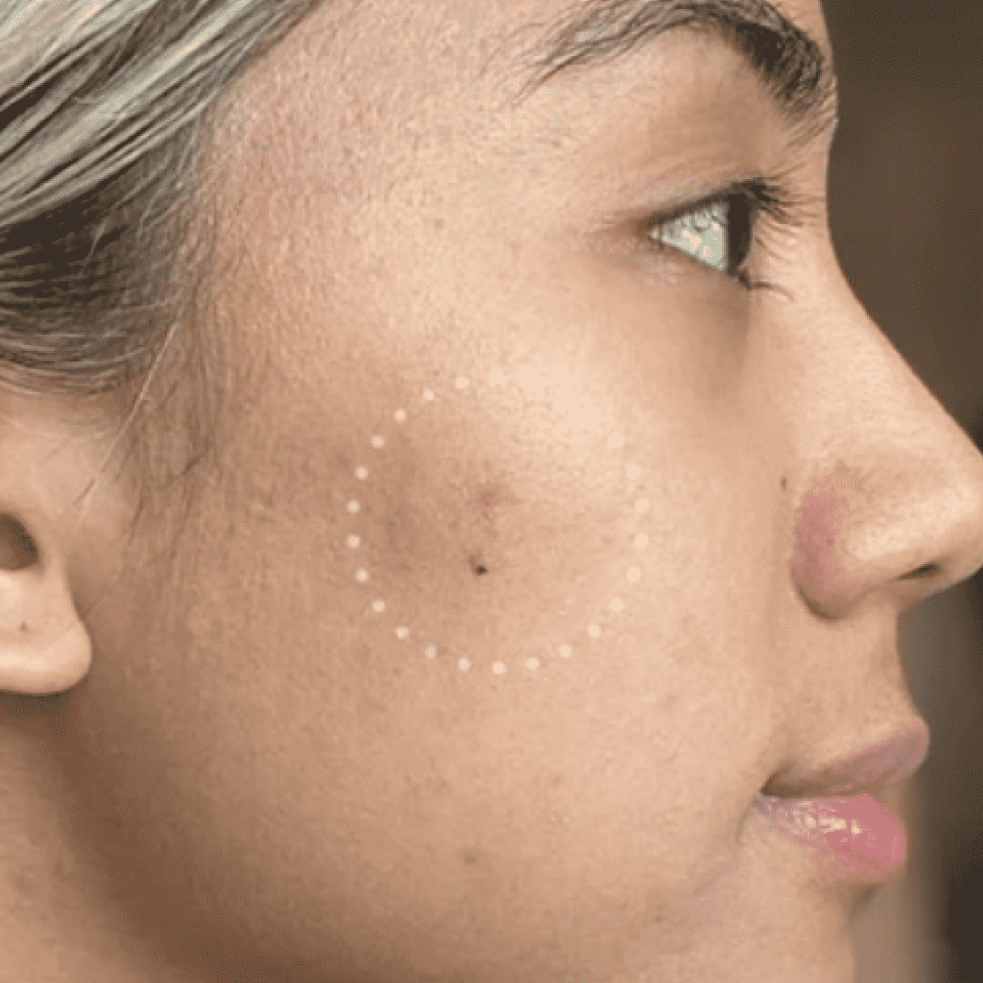 Mighty Patch™ for Dark Spots - Soft Shine
